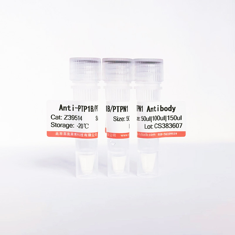 PTP1B/PTPN1抗体图片