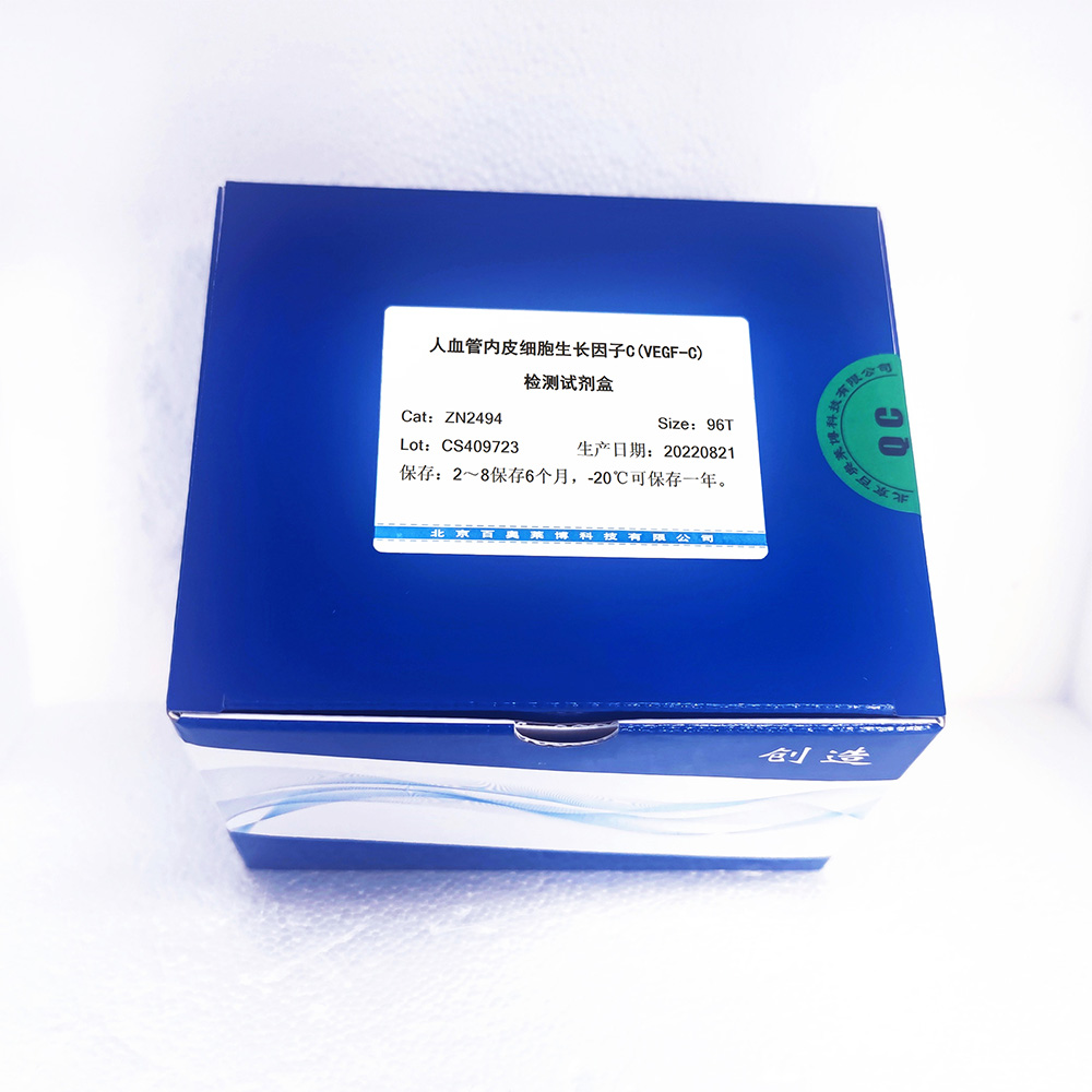 人血管内皮细胞生长因子C(VEGF-C)检测试剂盒图片 人血管内皮细胞生长因子C(VEGF-C)检测试剂盒图片